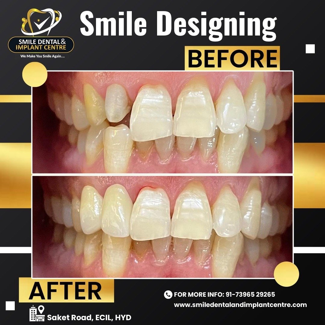 smile1