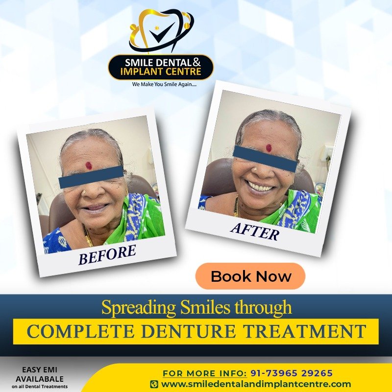 smile3